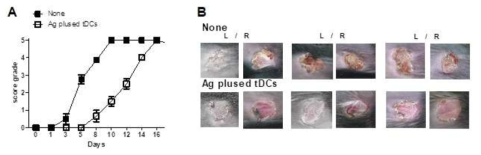 항-CD137 항체로 priming CD11b+ DC를 주입한 생쥐에서 피부 이식거부반응을 조사한 실험 결과