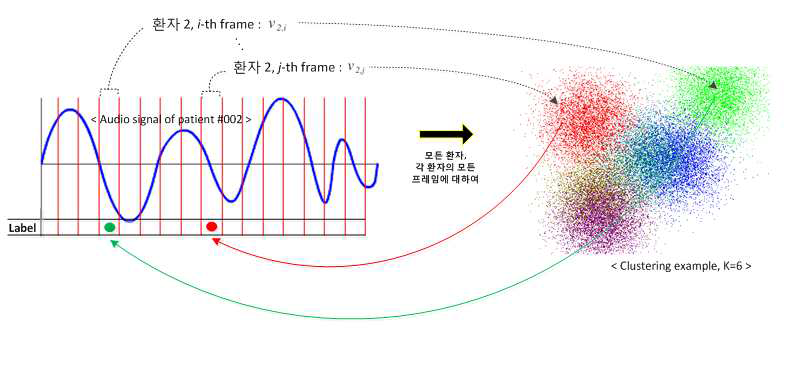 수면 호흡음의 특징점 추출 및 분류기를 통한 분류 예시