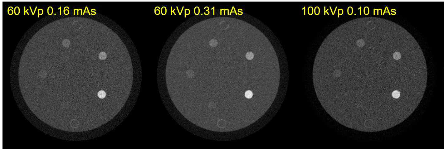 60/100 kVp 조합을 이용한 실험 영상 (좌 및 우 영상의 경우 상호간 선량값을 최대한 일치시킴)