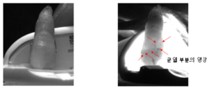 백색광 하에서의 균열 치아 이미지(좌), 근적외선(853 ㎚) LED 광원에 대한 균열 치아 이미지(우)