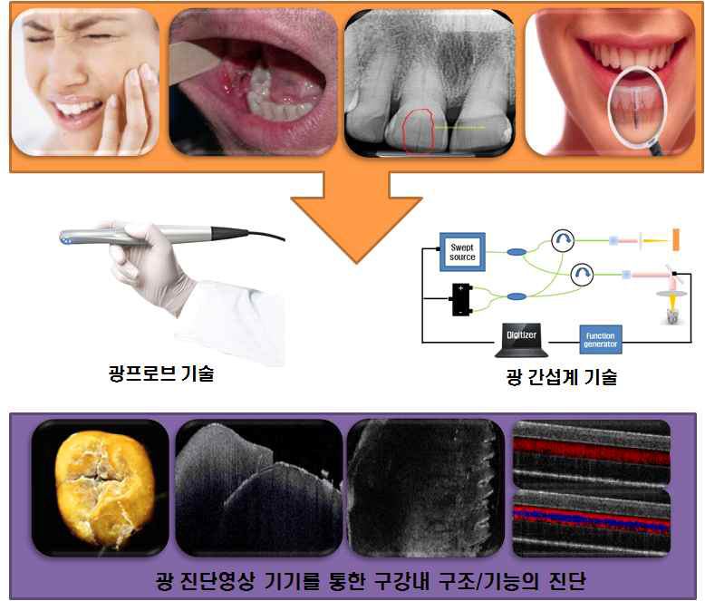 치아/치주 질환의 진단을 위한 비접촉 광 진단 영상기기 기술의 개념도