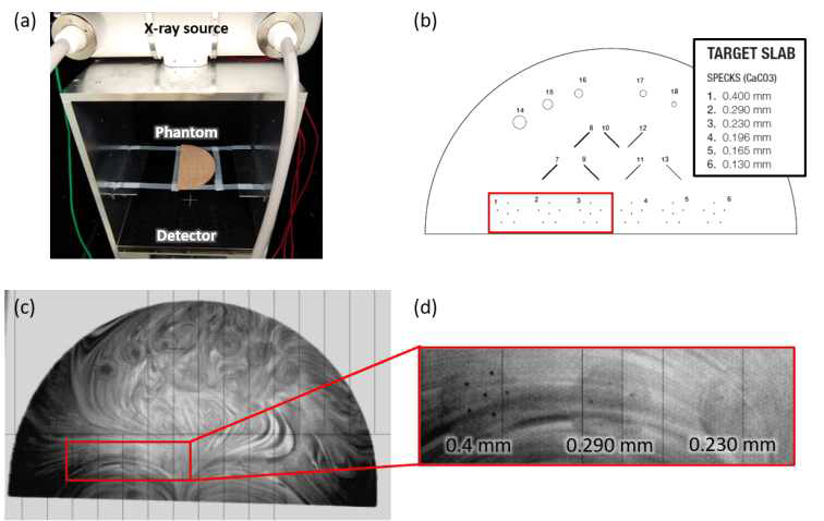 (a) 팬텀 이미지 촬영을 위한 실험 구조, (b) 유방 팬텀의 삽입물 크기 및 위치, (c) 회전형 아노드 엑스선 튜브를 이용해 촬영한 유방 팬텀 엑스선 이미지, (d) 입자 위치를 확대한 엑스선 이미지