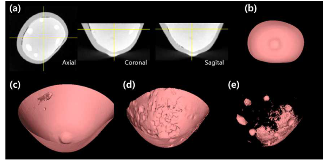 2세부 슬라이스 이미지로부터 재구성된 3차원 영상 (a) Axial, Coronal 및 Sagital 방향 단면 영상, 유방팬텀의 (b) 외부, (c) 외피의 내면, (d) 본체 표면 및 (e) Mass 병변의 Isosurface 영상