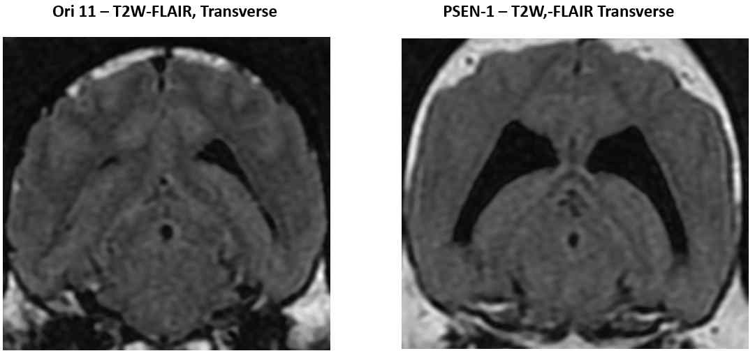 In FLAIR transverse images, No signs of periventricular hyperintensity in PSEN-1 dog