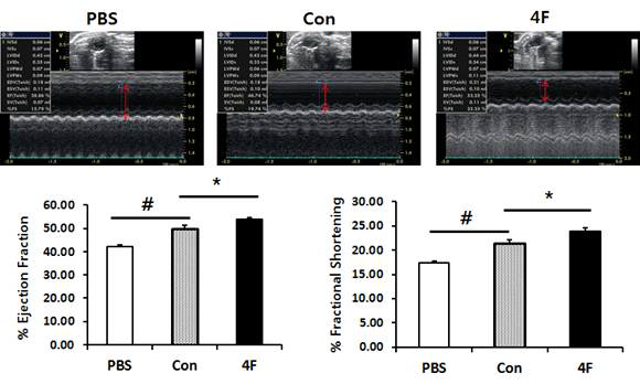 MI 모델에 4F 칵테일 단기 처리 세포 이식 후, 심초음파 관찰