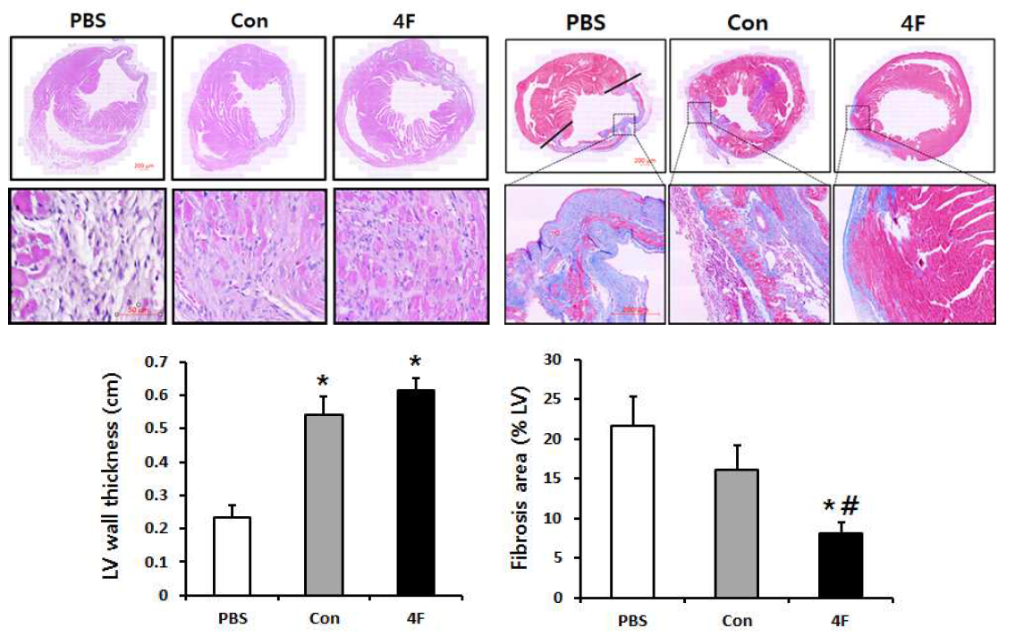 세포 이식 후, 심근 조직의 H&E 염색 및 fibrosis 분석 결과