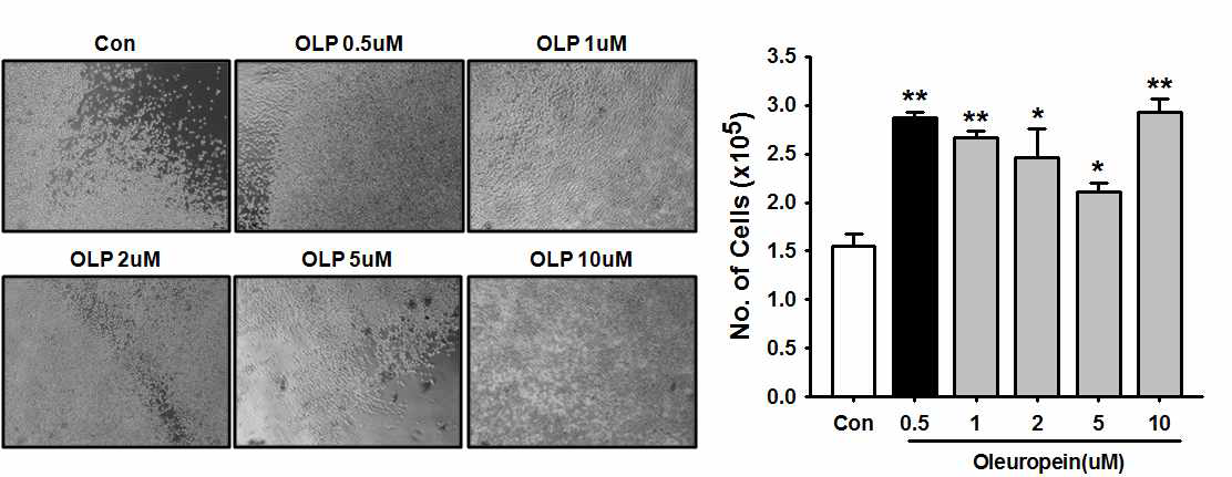 Oleuropein 농도별 처리 후 혈관줄기세포의 형태학적 특성 및 증식능 분석