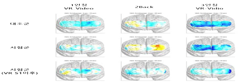 fNIRS 시행동안 시험군과 정상군의 뇌활성화 비교