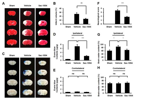 뇌 허혈성/재관류 (I/R) 모델에서 경구 투여를 통한 Sac-1004의 기능 분석