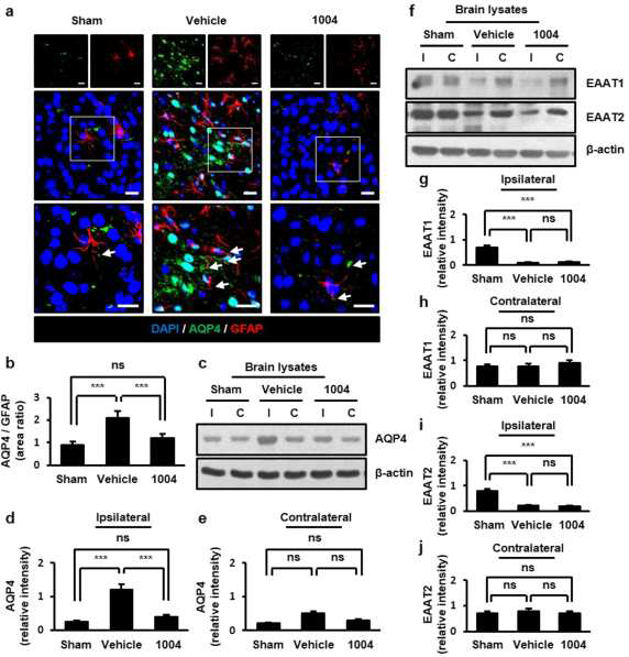 Astrocyte end-feet swelling에 관여하는 AQP4와 EAAT1/2의 발현 분석