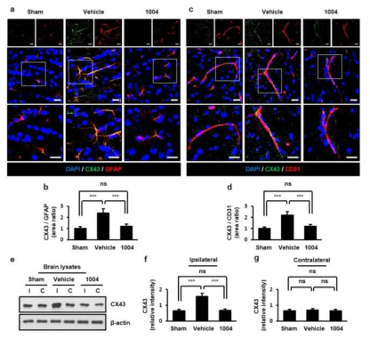 Astrocyte end-feet swelling에 관여하는 CX43의 발현 분석