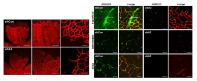 AMIGO2 결손 생쥐에서 망막혈관감소