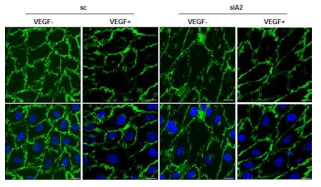 VE-cadherin 염색을 통한 세포간 접합능력 확인