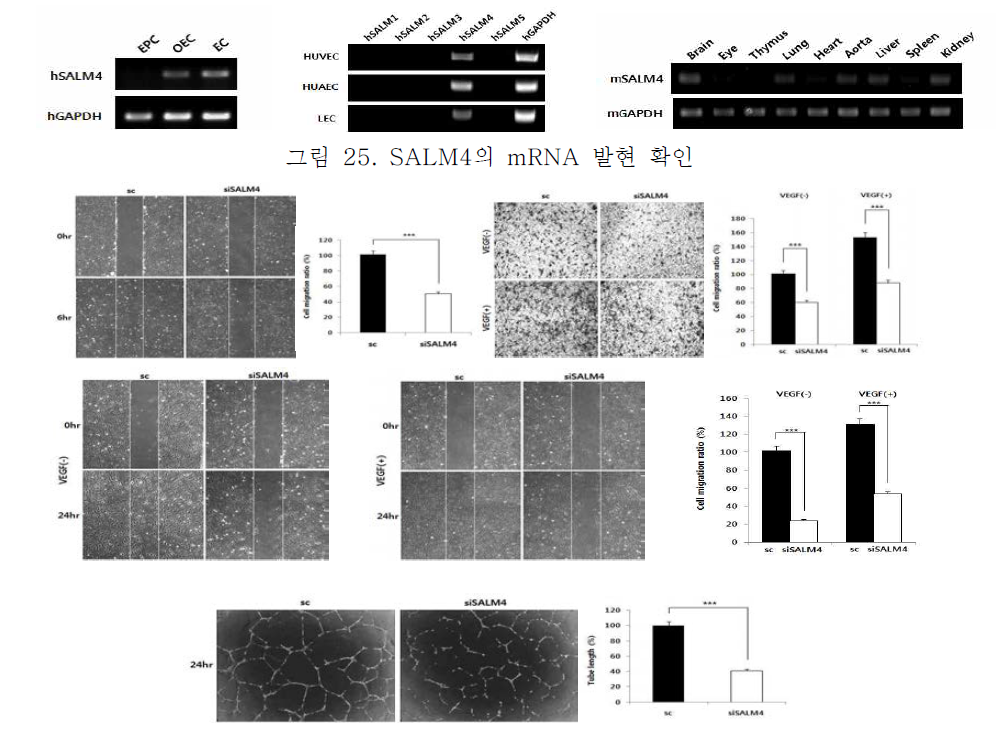 SALM4의 기능 확인