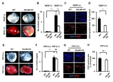 VEGF-A와 FGF-2에 의한 matrigel plug assay