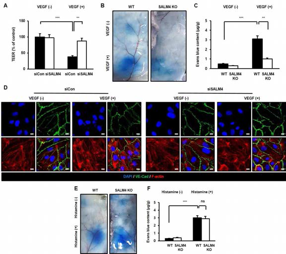 VEGF-A와 histamine에 의한 혈관 투과도 평가