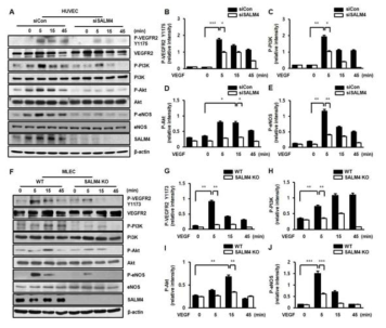 SALM4를 knockdown 한 EC와 SALM4 KO 쥐의 MLEC에서 VEGFR2-tyrosine 1175 신호전달의 분석