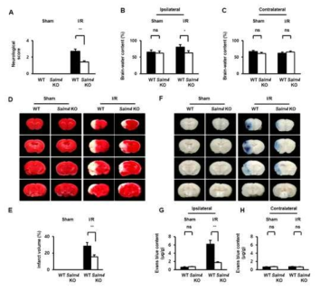 뇌 허혈성/재관류 (I/R) 모델에서 SALM4의 기능 분석