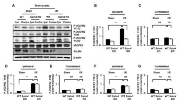SALM4 KO 뇌에서 VEGFR2의 인산화 자리 세 곳 분석