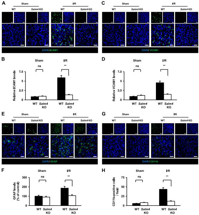 I/R 후 WT과 Salm4 KO mouse에서 neuroinflammation 관련 단백질의 발현 변화