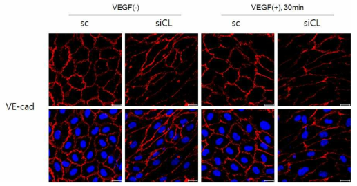 VE-cadherin단백질 면역형광염색을 통한 혈관내피세포의 접합 정도 확인