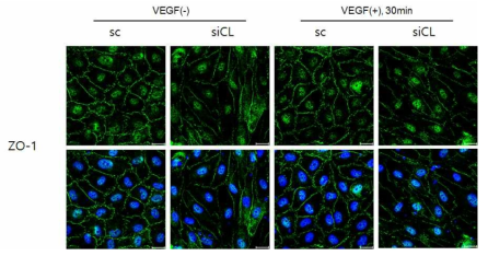 ZO-1단백질 면역형광염색을 통한 혈관내피세포의 접합 정도 확인