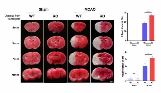 뇌졸중 모델에서 CLEC14A KO 마우스의 뇌손상 악화