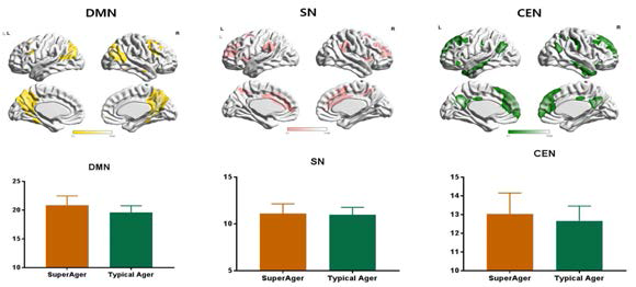 Intrinsic brain network