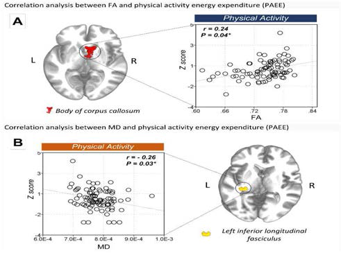 Correlation between FA values and life style in SuperAger