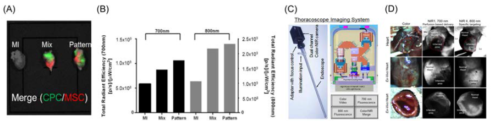 세포 추적을 위한 이미징 기술 개발. 형광 표지 후 제작한 패치형 구조체의 이식 효능 검증 실험 결과 (A) 형광 이미지, (B) 형광 이미징 기반의 정량적 분석, (C) 근적외선 형광영상이 가능한 흉강경, (D) 심장 국소괴사의 표적탐지 영상