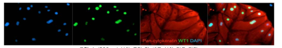 iPSC-epi 분화 공정 및 세포 분화 검증 결과