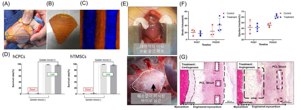 대동물 기반 바이오심근 예비 실험 수행 (A) 대동물용 바이오심근 디자인 과정, (B) 제작된 바이오심근 , (C) 바이오심근의 이중 세포 패터닝, (D) 젤라틴을 이용한 바이오심근의 전달 이후 세포생존률, (E) 바이오심근 이식 프로세스 확립으로 인한 안정적인 바이오심근 봉합. (F) Echocardiography에 따른 대조군 대비 패치 이식 그룹의 4주 후 SV 및 EF 변화 관찰(SV: ctrl n=3, patch n=4 EF: n=4), (G) MT staining에 따른 대조군 대비 패치 이식 그룹의 형상 변화 관찰