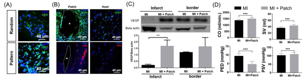 대동물 기반 바이오심근의 분석 기법 수행 (A) 무작위로 배열된 세포 디자인과 제안된 패치 간의 CD31 면역 염색 이미지 비교, (B) 면역 염색을 통한 이식 후 추출된 대동물 조직 내부의 인간 타겟 CD31, HNA 발현 관찰, (C) Western blot 기법에 따른 대조군 대비 패치 이식 그룹의 VEGF 변화의 정량적 관찰 (MI n=1, patch n=2), (D) PV-loop 분석 기법에서 측정된 대조군 대비 CO, SV, PED, PSV 비교 관찰 (MIn=4, patch=3)