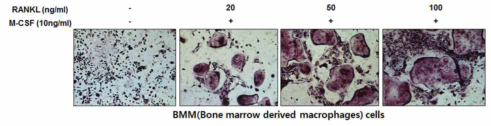 TRAP assay in Bone marrow derived macrophages cells