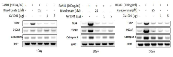 Risedronate와 GV1001이 파골세포 분화마커 발현에 미치는 영향