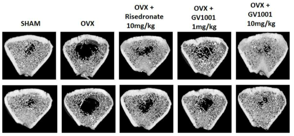 Effect of Risedronate and GV1001 on OVX animal model