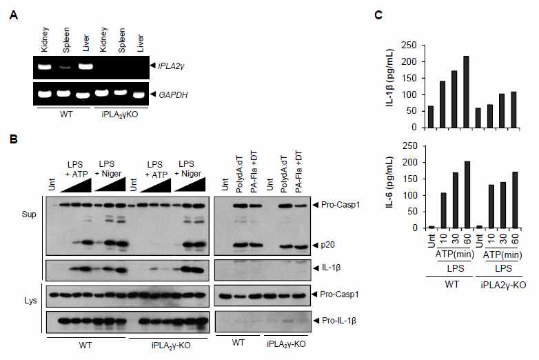 iPLA2γ 결핍 대식세포에서 인플라마좀 활성 측정
