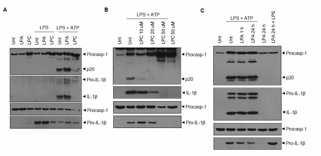 LPC 의 inflammasome 조절효과