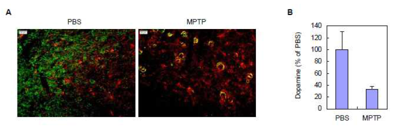 MPTP 주입에 의한 마우스 SN 조직에서 도파민 뉴런의 손실 (green: TH+ neuron)