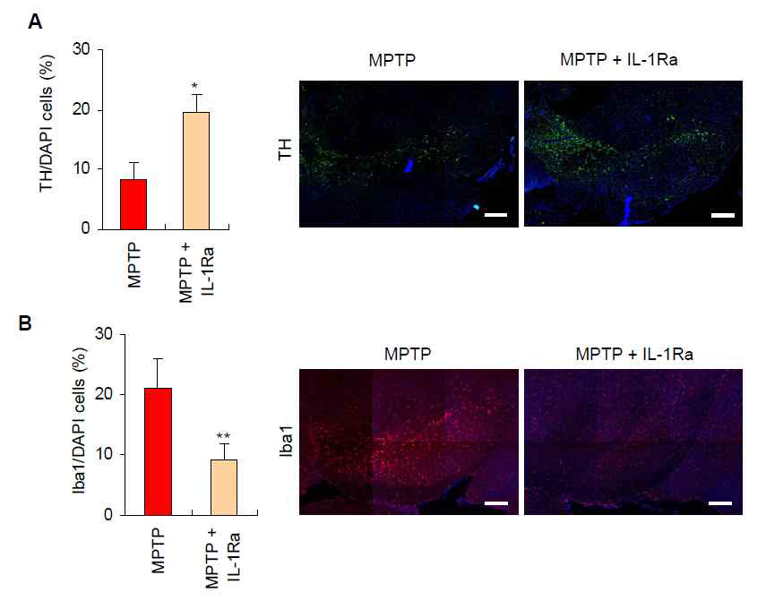 IL-1 수용체 길항제의 MPTP 유도 도파민 뉴런 사멸, microglia 증가 조절