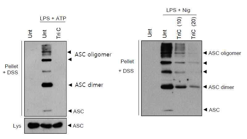 Lipid droplet 생성 저해를 통한 ASC speck 형성 감소