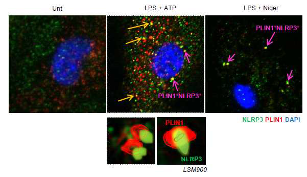 NLRP3 활성 조건에서 NLRP3 와 lipid droplet 의 colocalization 확인