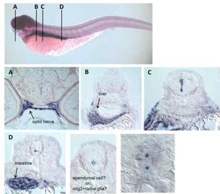 wholemount in situ hybridization을 통한 phyh 유전자의 발현 분석