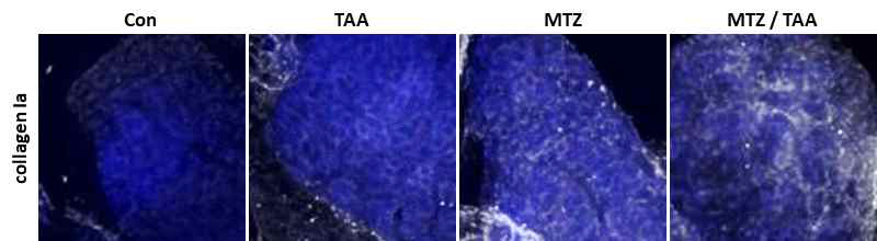 TAA 간섬유증 모델 개발