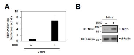 Inducible NICD 발현 사람평활근세포 제작