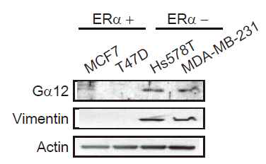 ERα positive, negative 유방암 세포주에서 Gα12 발현의 차이