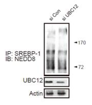 Neddylation을 통한 SREBP-1 단백질의 발현양 변화