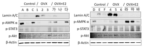 에스트로겐 투여에 의한 lamin A/C와 PKM2 발현 관찰