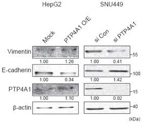 PTP4A1의 발현 조절과 EMT marker 변화 관찰