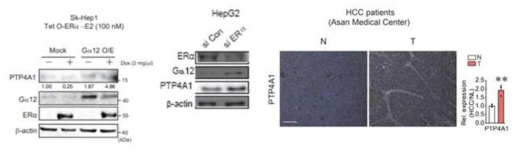세포주 모델 및 인체유래자원 분석을 통한 PTP4A1과 ERa/Ga12 axis의 조절 관계 검증